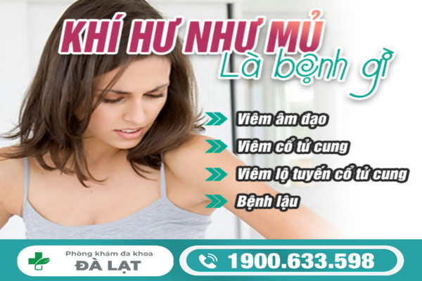Hình ảnh minh họa